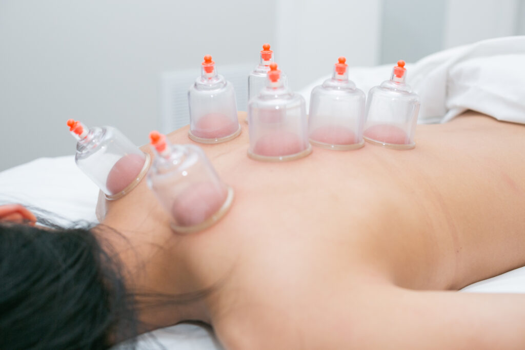 Dry & Wet Cupping