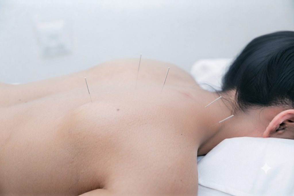 Dry Needling